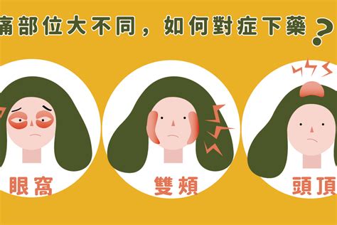 容易頭痛的原因|頭痛怎麼辦？何時該就醫？秒懂頭痛原因、位置及症狀｜元氣